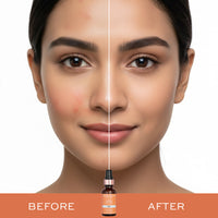 Revolution Skincare 3% Vitamin C Serum Revolution Skincare 3% Vitamin C Serum