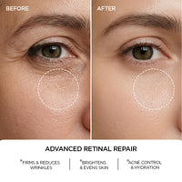REVOX B77 JUST RETINAL 0.2% FLUID REVOX B77 JUST RETINAL 0.2% FLUID