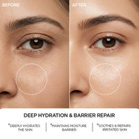 REVOX B77 JUST HYALURONIC ACID 5% REVOX B77 JUST HYALURONIC ACID 5%