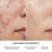 REVOX B77 JUST NIACINAMIDE 10% REVOX B77 JUST NIACINAMIDE 10%