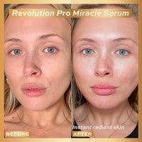 Revolution Pro Miracle Serum Revolution Pro Miracle Serum