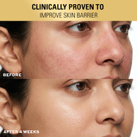 Revolution Pro Miracle 2% Salicylic Acid BHA Anti Blemish Serum Revolution Pro Miracle 2% Salicylic Acid BHA Anti Blemish Serum