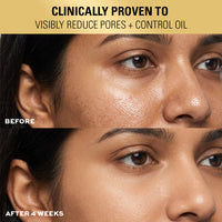 Revolution Pro Miracle 2% Salicylic Acid BHA Anti Blemish Serum Revolution Pro Miracle 2% Salicylic Acid BHA Anti Blemish Serum