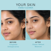 Eveline Cosmetics Cream-ampoule Niacynamid Therapy Reduction Of Imperfections Day/Night 50 ml Eveline Cosmetics Cream-ampoule Niacynamid Therapy Reduction Of Imperfections Day/Night 50 ml