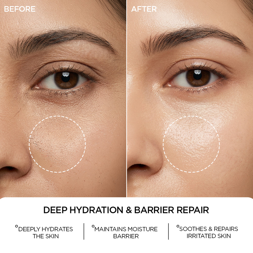 REVOX B77 JUST HYALURONIC ACID 5%