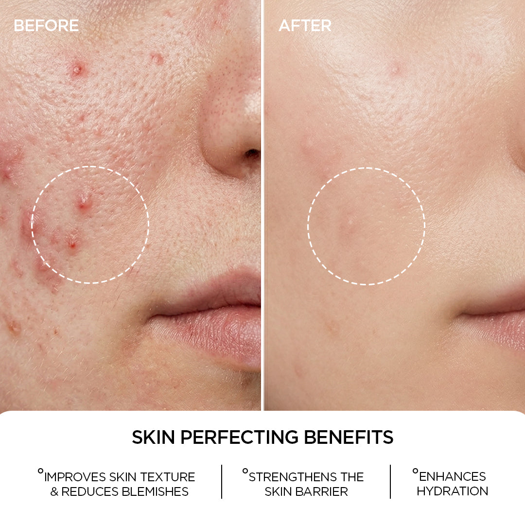 REVOX B77 JUST NIACINAMIDE 10%