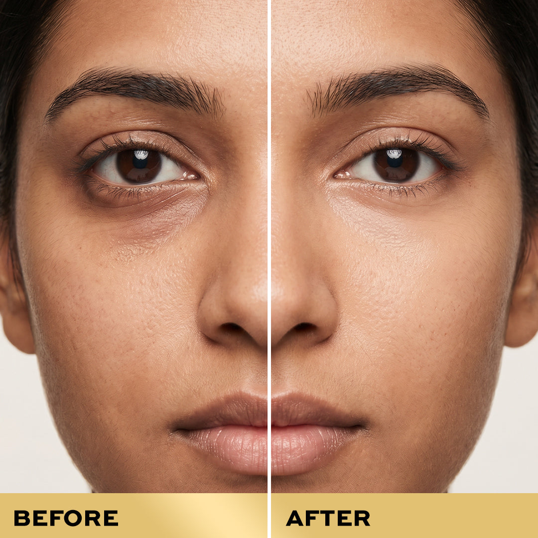 Revolution Pro Miracle 5% Caffeine Solution & Hyaluronic Acid Under Eye Serum