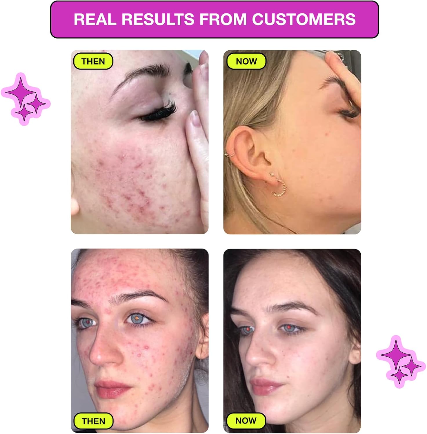 Carbon Theory VaPOREize Nose Pore Strips with Niacinamide x8