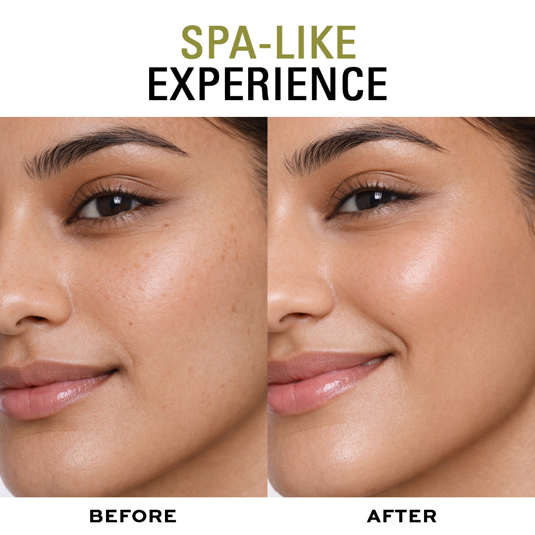 Revolution Skincare Dark Spot Corrector