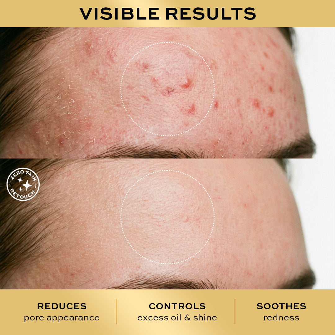 Revolution Pro Miracle 10% Niacinamide & 1% Zinc Serum