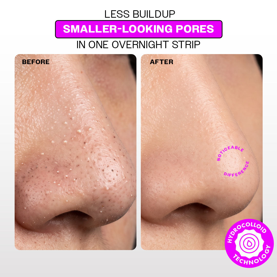 Carbon Theory VaPOREize Nose Pore Strips with Niacinamide x8