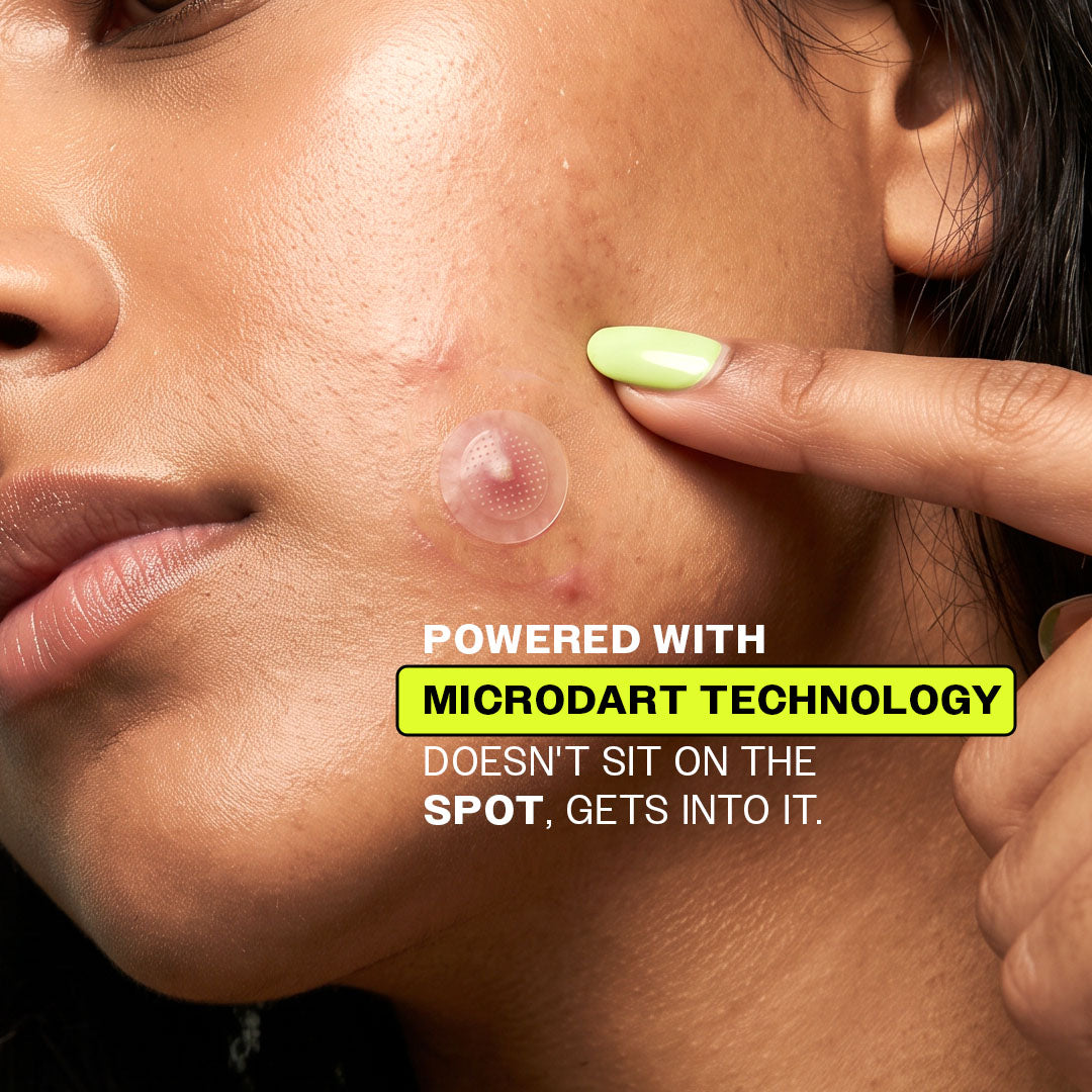 Carbon Theory Supacylic Salicylic Acid Microdart Spot Patches Hypa Dart X9