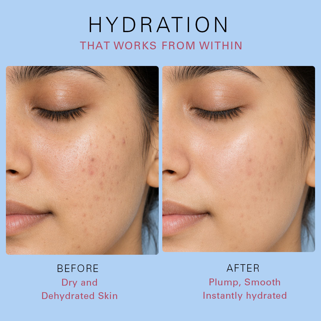 Serum Shot 2% Hyaluronic Acid Moisturization 30ml