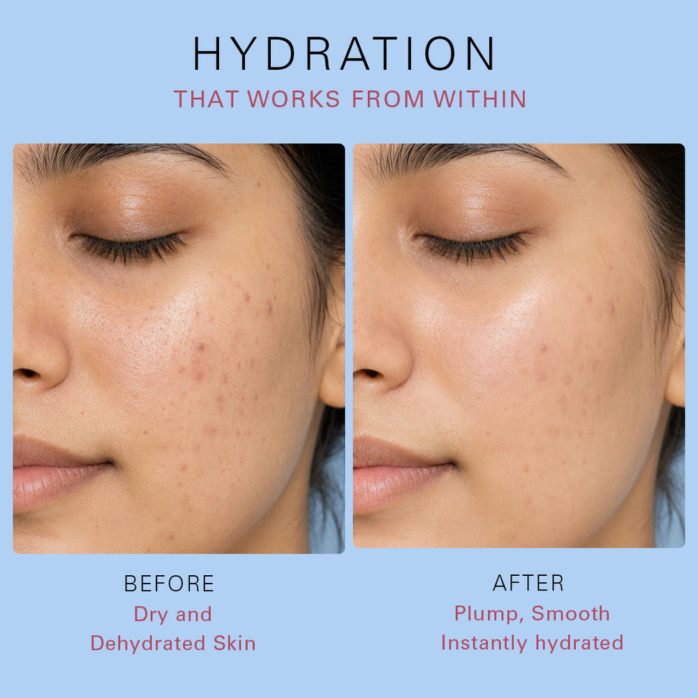 Serum Shot 2% Hyaluronic Acid Moisturization 30ml