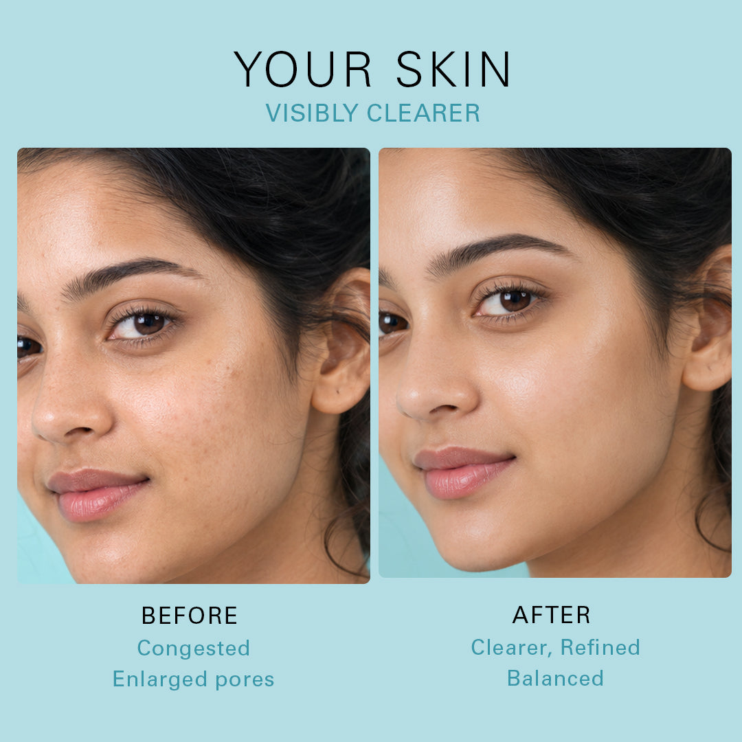 Eveline Cosmetics Cream-ampoule Niacynamid Therapy Reduction Of Imperfections Day/Night 50 ml